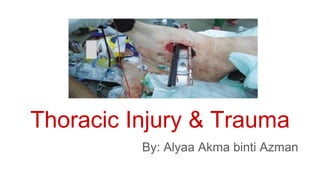 Thoracic Injury & Trauma
By: Alyaa Akma binti Azman
 
