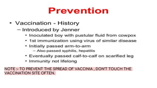 NOTE :- TO PREVENT THE SPREAD OF VACCINIA , DON’T TOUCH THE
VACCINATION SITE OFTEN.
 