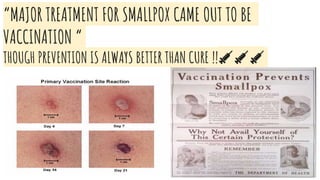 “MAJOR TREATMENT FOR SMALLPOX CAME OUT TO BE
VACCINATION “
THOUGH PREVENTION IS ALWAYS BETTER THAN CURE !!💉💉💉
 