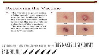 SINCE THE NEEDLE IS USED TO PRICK THE SKIN A NO. OF TIMES !!! THIS MAKES IT SERIOUSLY
PAINFUL !!!!! 💉💉💉💉💉💉
 