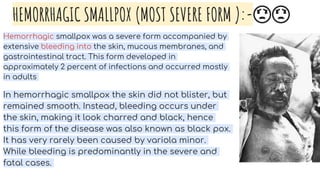 HEMORRHAGIC SMALLPOX (MOST SEVERE FORM ):-😟😟
Hemorrhagic smallpox was a severe form accompanied by
extensive bleeding into the skin, mucous membranes, and
gastrointestinal tract. This form developed in
approximately 2 percent of infections and occurred mostly
in adults
In hemorrhagic smallpox the skin did not blister, but
remained smooth. Instead, bleeding occurs under
the skin, making it look charred and black, hence
this form of the disease was also known as black pox.
It has very rarely been caused by variola minor.
While bleeding is predominantly in the severe and
fatal cases.
 
