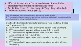 Effect of ferrule and post - journal club Effect of ferrule and post placement on fracture resistance of endodontically treated teeth after fatigue loading