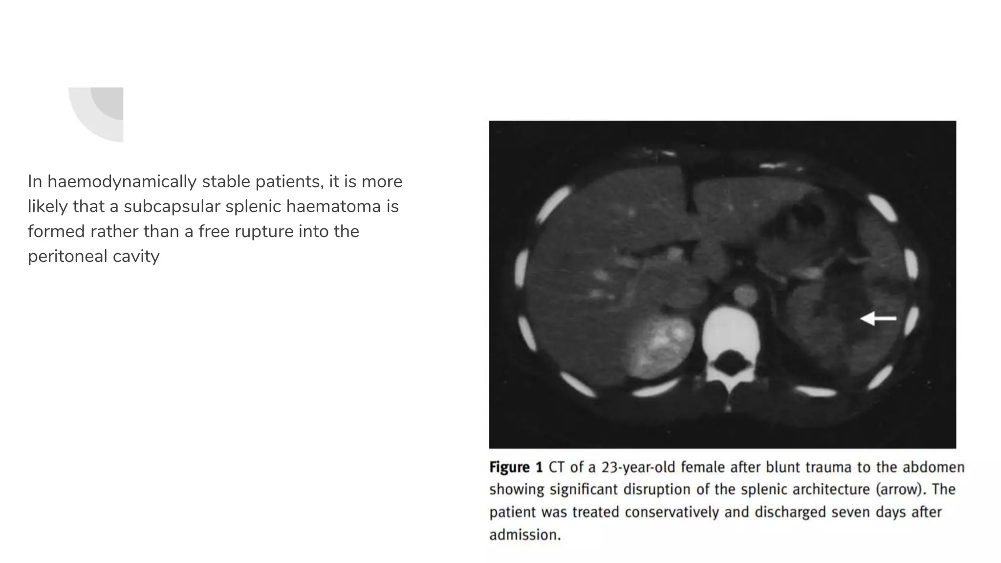 In haemodynamically stable patients, it is more
likely that a subcapsular splenic haematoma is
formed rather than a free rupture into the
peritoneal cavity
 