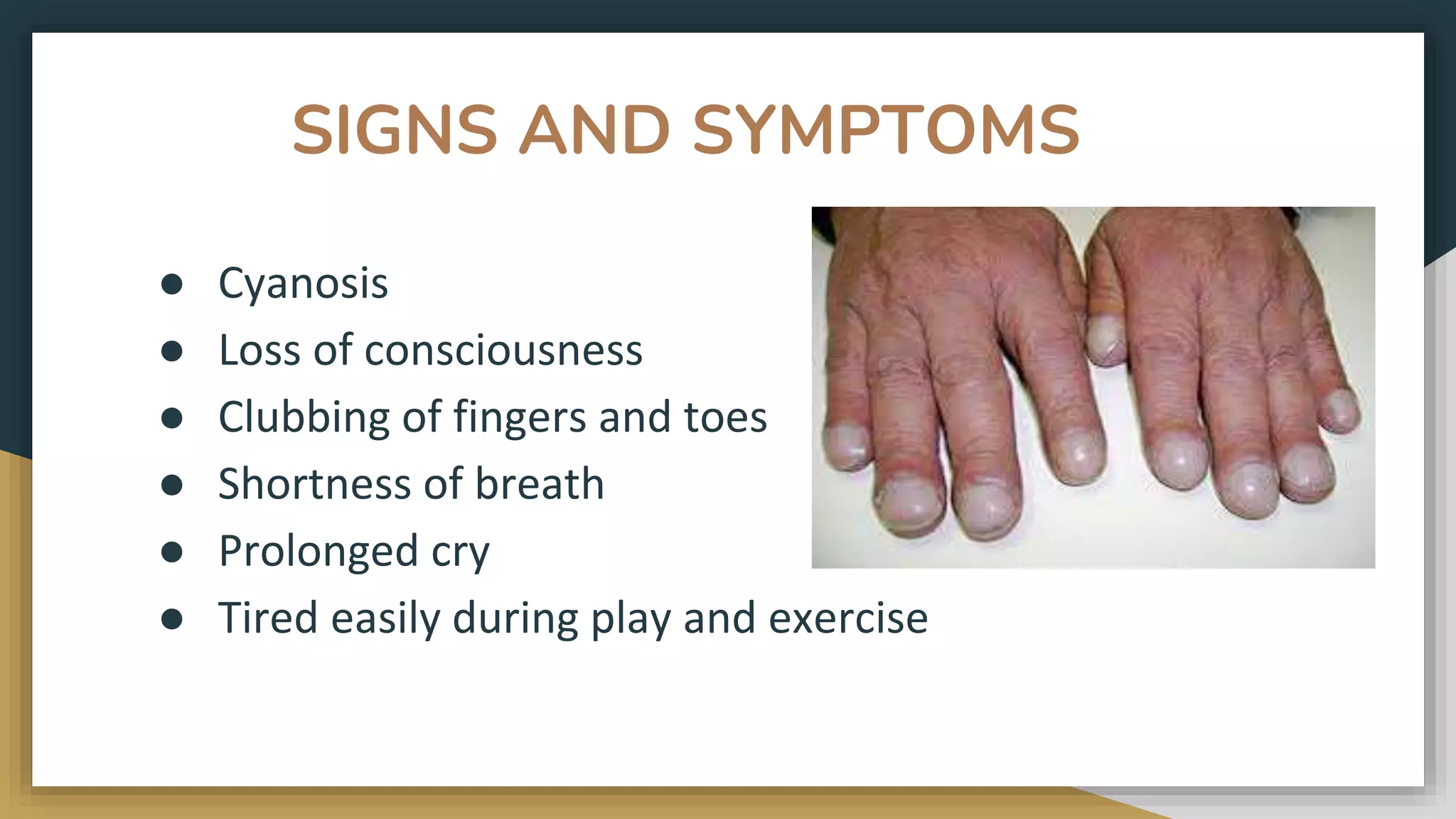SIGNS AND SYMPTOMS
● Cyanosis
● Loss of consciousness
● Clubbing of fingers and toes
● Shortness of breath
● Prolonged cry
● Tired easily during play and exercise
 