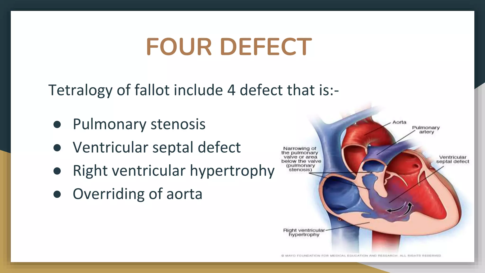 FOUR DEFECT
Tetralogy of fallot include 4 defect that is:-
● Pulmonary stenosis
● Ventricular septal defect
● Right ventricular hypertrophy
● Overriding of aorta
 