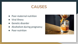 CAUSES
● Poor maternal nutrition
● Viral illness
● Genetic disorder
● Alcoholism during pregnancy
● Poor nutrition
 