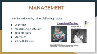 MANAGEMENT
It can be reduced by taking following steps:-
● Squatting
● Prostaglandin infusion
● Beta blockers
● Morphine
● Saline 0.9% bolus
 
