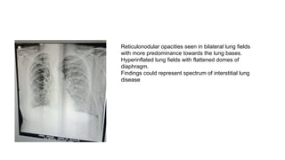 clinico-radiological meet - X rays with clinical | PPTX
