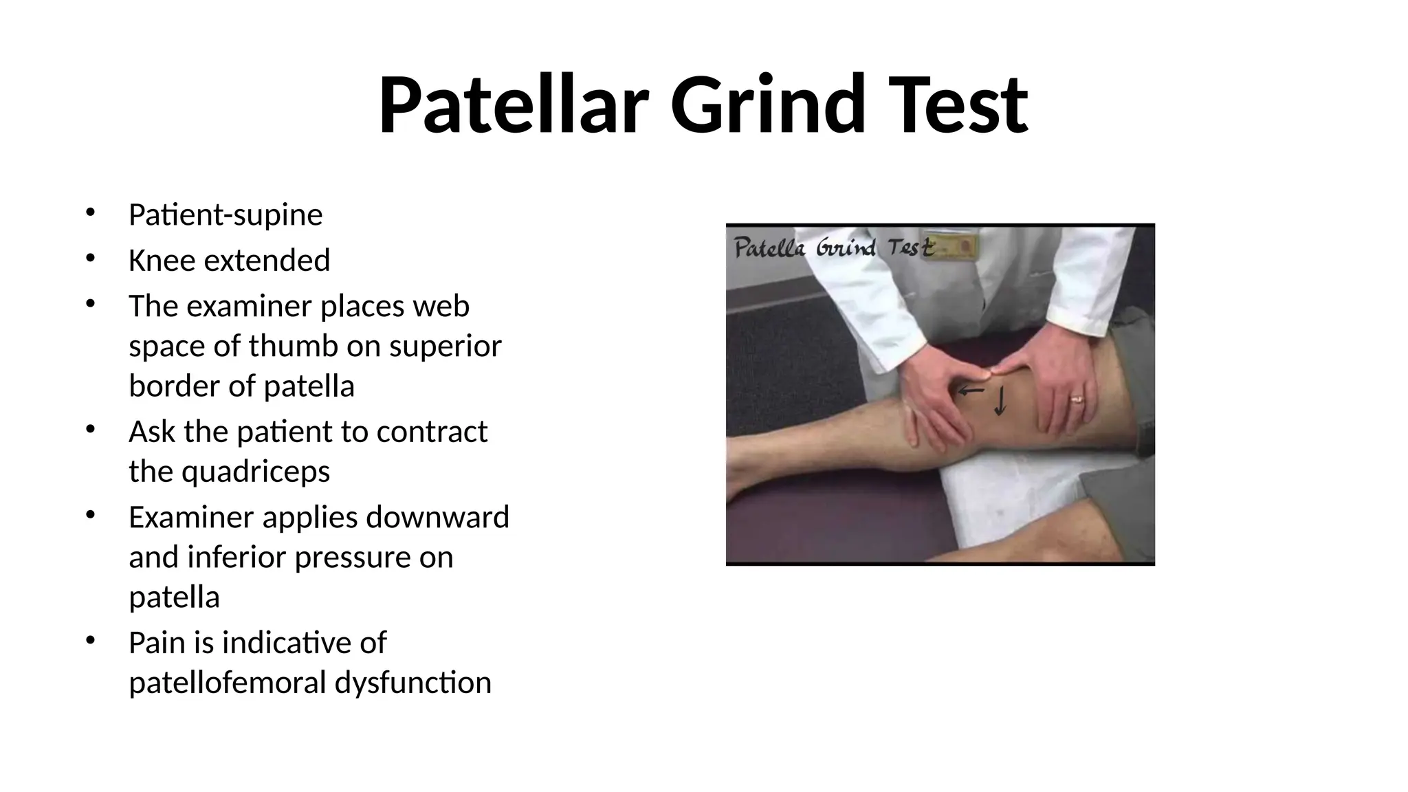 Patellar Grind Test
• Patient-supine
• Knee extended
• The examiner places web
space of thumb on superior
border of patella
• Ask the patient to contract
the quadriceps
• Examiner applies downward
and inferior pressure on
patella
• Pain is indicative of
patellofemoral dysfunction
 