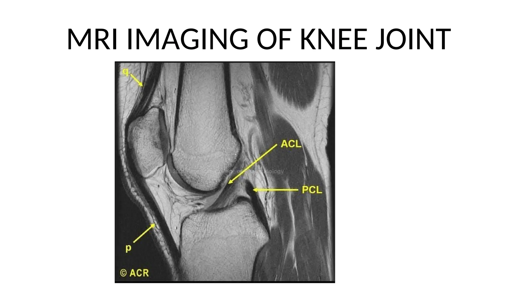 MRI IMAGING OF KNEE JOINT
 