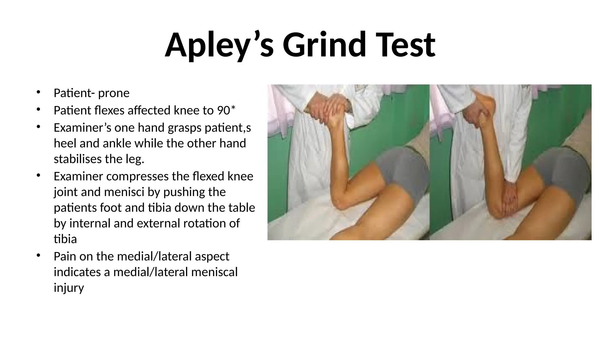 Apley’s Grind Test
• Patient- prone
• Patient flexes affected knee to 90*
• Examiner’s one hand grasps patient,s
heel and ankle while the other hand
stabilises the leg.
• Examiner compresses the flexed knee
joint and menisci by pushing the
patients foot and tibia down the table
by internal and external rotation of
tibia
• Pain on the medial/lateral aspect
indicates a medial/lateral meniscal
injury
 