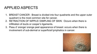 applied anatomy of breast for final year surgery | PPTX