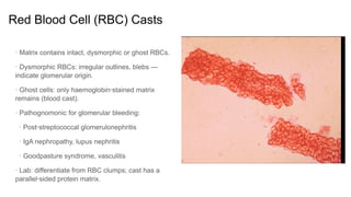 Comprehensive Guide to Urinary Casts in Clinical Diagnostics | PDF