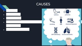 CAUSES
● Smoking
● Heavy dust
● Air pollution
● Exposure to chemical or
toxic fumes
● Genetic conditions
 