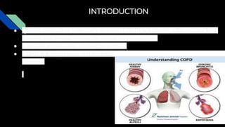 INTRODUCTION
● Chronic obstructive pulmonary disease (COPD) is a chronic inflammatory lung
disease that causes obstructed airflow from the lungs.
● It include emphysema, chronic bronchitis.
● COPD is a progressive and incurable
disease.
 