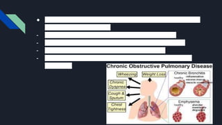 ● In COPD less air flows in and out of the airway because of one
or more of the following :-
- The airway and the air sacs lose their elastic quality .
- The walls between many of the air sacs are destroyed .
- The walls of airways become thick and inflamed.
- The airways makes more mucus than usual, which tends to
clog them.
 