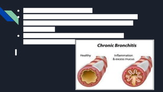 ● These tiny hairs are called cilia.
● The cilia help move mucus up the tubes so it can be
coughed out. In chronic bronchitis, the tubes have
lost their cilia.
● This makes it hard to cough up mucus, which
causes more coughing.
 