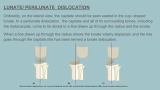 appendicular trauma in radiology. .pptx