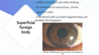 Superﬁcial
foreign
body
⇢ sudden discomfort and reflex blinking.
⇢ FB embedded on conjunctiva , cornea
⇢ may form ulcer
⇢ if combined with a virulent organism,they can
develop into hypopyon.
 