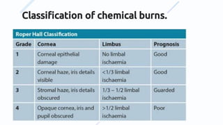 Classiﬁcation of chemical burns.
 