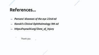 References...
⇢ Parsons' diseases of the eye 22nd ed
⇢ Kanski's Clinical Ophthalmology 9th ed
⇢ https:/
/eyewiki.org/Zone_of_Injury
⇢
⇢
Thank you
 