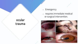 ocular
trauma
⇢ Emergency
⇢ requires immediate medical
or surgical intervention.
 