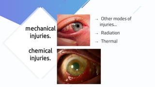 mechanical
injuries.
chemical
injuries.
⇢ Other modes of
injuries...
⇢ Radiation
⇢ Thermal
 