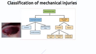 Classiﬁcation of mechanical injuries
 