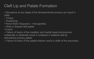 cleft lip and palate by malik ashim | PPTX