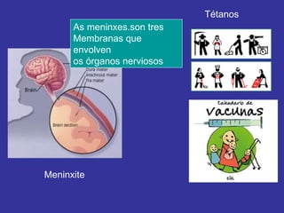 Meninxite Tétanos As meninxes.son tres Membranas que envolven  os órganos nerviosos 