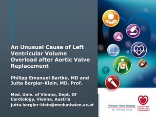 An Unusual Cause of Left
Ventricular Volume
Overload after Aortic Valve
Replacement
Philipp Emanuel Bartko, MD and
Jutta Bergler-Klein, MD, Prof.
Med. Univ. of Vienna, Dept. Of
Cardiology, Vienna, Austria
jutta.bergler-klein@meduniwien.ac.at

 