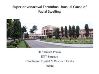 Superior venacaval Thrombus Unusual Cause of
Facial Swelling
Dr Shrikant Phatak
ENT Surgeon
Choithram Hospital & Research Center
Indore
 