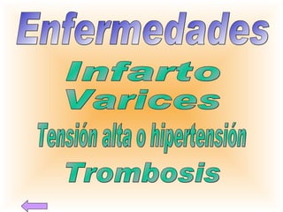 Enfermedades Infarto Varices Tensión alta o hipertensión Trombosis 