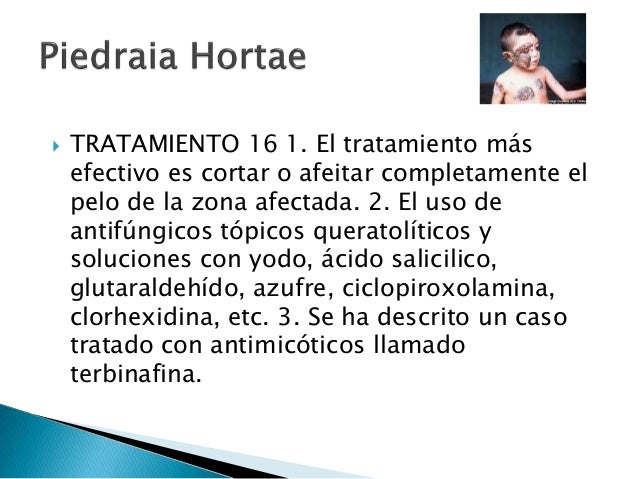 Las sospechas a las lombrices a que ir al médico