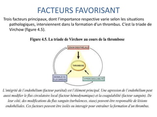 FACTEURS FAVORISANT
Trois facteurs principaux, dont l’importance respective varie selon les situations
pathologiques, interviennent dans la formation d’un thrombus. C’est la triade de
Virchow (figure 4.5).
 