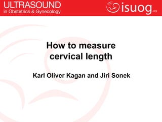 How to measure
cervical length
Karl Oliver Kagan and Jiri Sonek
 