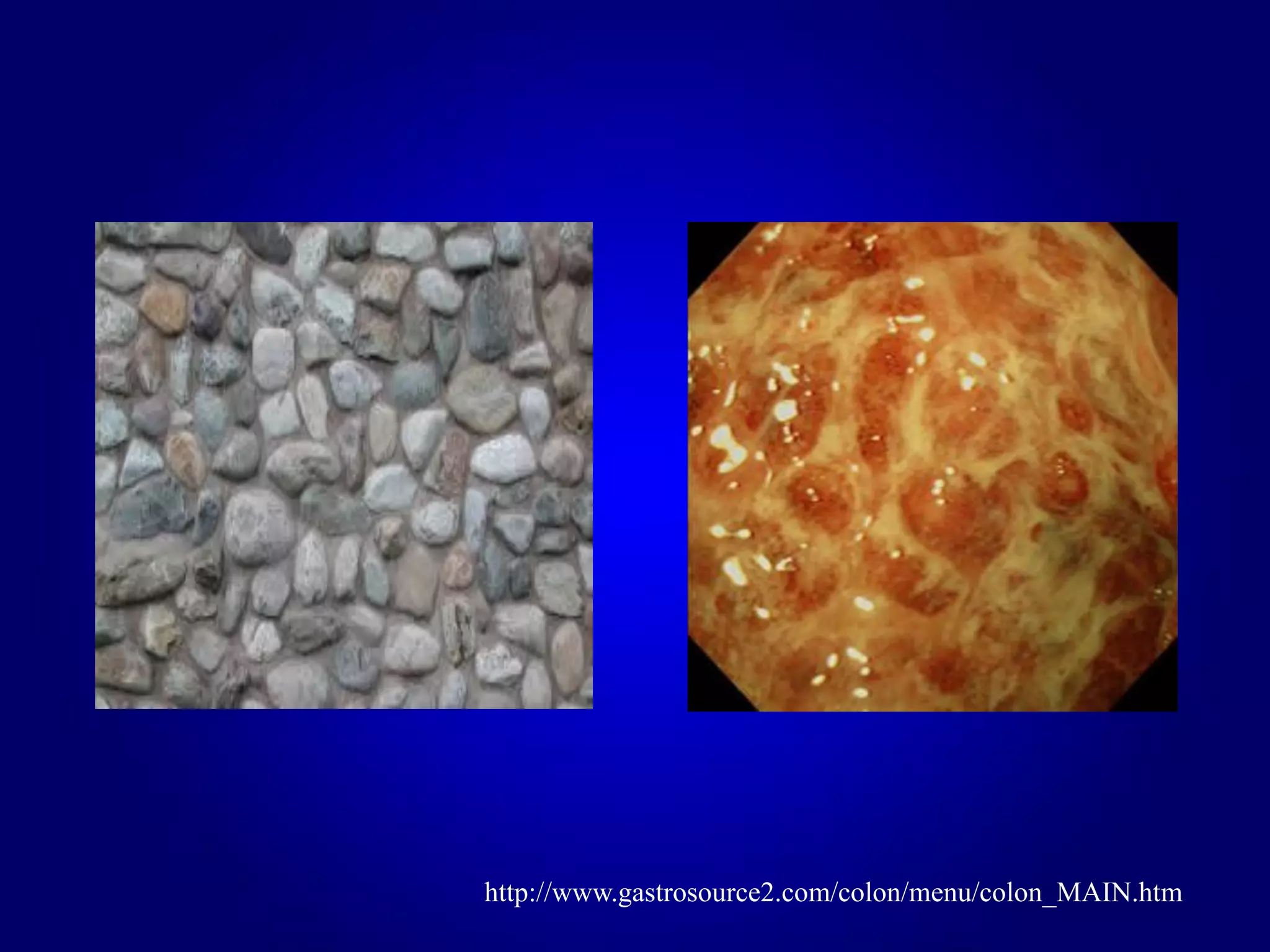 http://www.gastrosource2.com/colon/menu/colon_MAIN.htm
 