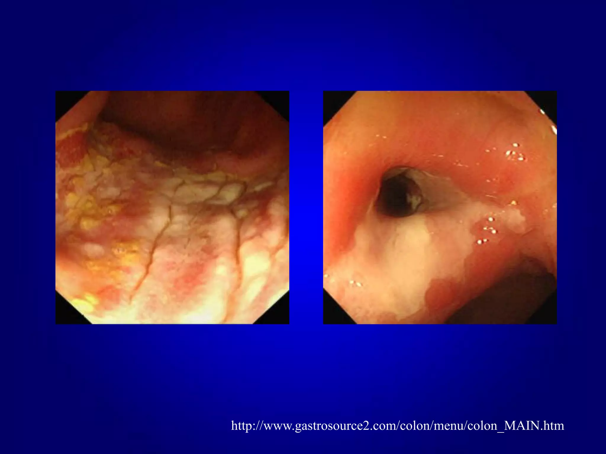 http://www.gastrosource2.com/colon/menu/colon_MAIN.htm
 