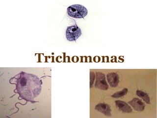 Trichomonas 
 