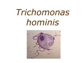 Trichomonas 
hominis 
 