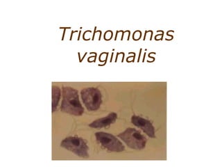 Trichomonas 
vaginalis 
 