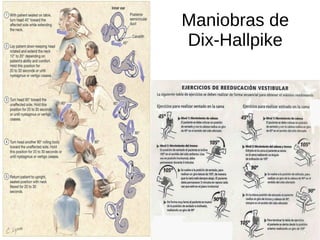 Maniobras de
Dix-Hallpike
 