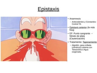 Epistaxis
● Anamnesis
– Antecedentes y Constantes:
Control TA
● Epistaxis anterior (lo más
freq)
● EF: Punto sangrante →
Nitrato de plata
(Cauterización)
● Tratamiento: Taponamiento
– Algodón, gasa orillada
(cilíndrica) cubierta con
Tetraciclina o Agua
oxigenada.
 