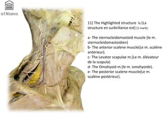 11) The Highlighted structure is (La 
structure en surbrillance est) (1 mark): 
a- The sternocleidomastoid muscle (le m. 
sternocleidomastoidien) 
b- The anterior scalene muscle(Le m. scalène 
antérieur). 
c- The Levator scapulae m.(Le m. élévateur 
de la scapula) 
d- The Omohyoid m.(le m. omohyoide). 
e- The posterior scalene muscle(Le m. 
scalène postérieur). 
 