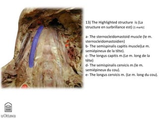 13) The Highlighted structure is (La 
structure en surbrillance est) (1 mark): 
a- The sternocleidomastoid muscle (le m. 
sternocleidomastoidien) 
b- The semispinalis capitis muscle(Le m. 
semiépineux de la tête). 
c- The longus capitis m.(Le m. long de la 
tête) 
d- The semispinalis cervicis m.(le m. 
semiépineux du cou). 
e- The longus cervicis m. (Le m. long du cou). 
 