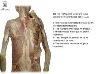 14) The Highlighted structure is (La 
structure en surbrillance est) (1 mark): 
a- The sternocleidomastoid muscle (le m. 
sternocleidomastoidien) 
b- The trapezius muscle(Le m. trapèze). 
c- The rhomboid major.(Le m. grand 
rhomboid) 
d- The semispinalis cervicis m.(le m. 
semiépineux du cou). 
e- The rhomboid minor.(Le m. petit 
rhomboid) 
 