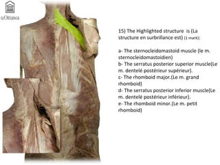 15) The Highlighted structure is (La 
structure en surbrillance est) (1 mark): 
a- The sternocleidomastoid muscle (le m. 
sternocleidomastoidien) 
b- The serratus posterior superior muscle(Le 
m. dentelé postérieur supérieur). 
c- The rhomboid major.(Le m. grand 
rhomboid) 
d- The serratus posterior inferior muscle(Le 
m. dentelé postérieur inférieur). 
e- The rhomboid minor.(Le m. petit 
rhomboid) 
 
