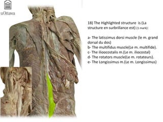 18) The Highlighted structure is (La 
structure en surbrillance est) (1 mark): 
a- The latissimus dorsi muscle (le m. grand 
dorsal du dos) 
b- The multifidus muscle(Le m. multifide). 
c- The ilioocostalis m.(Le m. iliocostal) 
d- The rotators muscle(Le m. rotateurs). 
e- The Longissimus m.(Le m. Longissimus) 
 