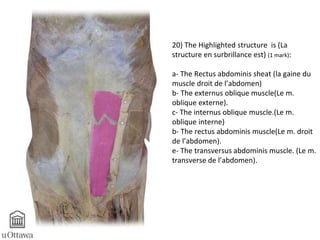20) The Highlighted structure is (La 
structure en surbrillance est) (1 mark): 
a- The Rectus abdominis sheat (la gaine du 
muscle droit de l’abdomen) 
b- The externus oblique muscle(Le m. 
oblique externe). 
c- The internus oblique muscle.(Le m. 
oblique interne) 
b- The rectus abdominis muscle(Le m. droit 
de l’abdomen). 
e- The transversus abdominis muscle. (Le m. 
transverse de l’abdomen). 
 