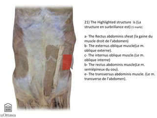21) The Highlighted structure is (La 
structure en surbrillance est) (1 mark): 
a- The Rectus abdominis sheat (la gaine du 
muscle droit de l’abdomen) 
b- The externus oblique muscle(Le m. 
oblique externe). 
c- The internus oblique muscle.(Le m. 
oblique interne) 
b- The rectus abdominis muscle(Le m. 
semiépineux du cou). 
e- The transversus abdominis muscle. (Le m. 
transverse de l’abdomen). 
 